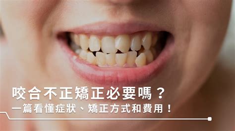 嘴巴閉起來牙齒|咬合不正怎麼辦？3分鐘認識咬合類型、症狀與矯正方。